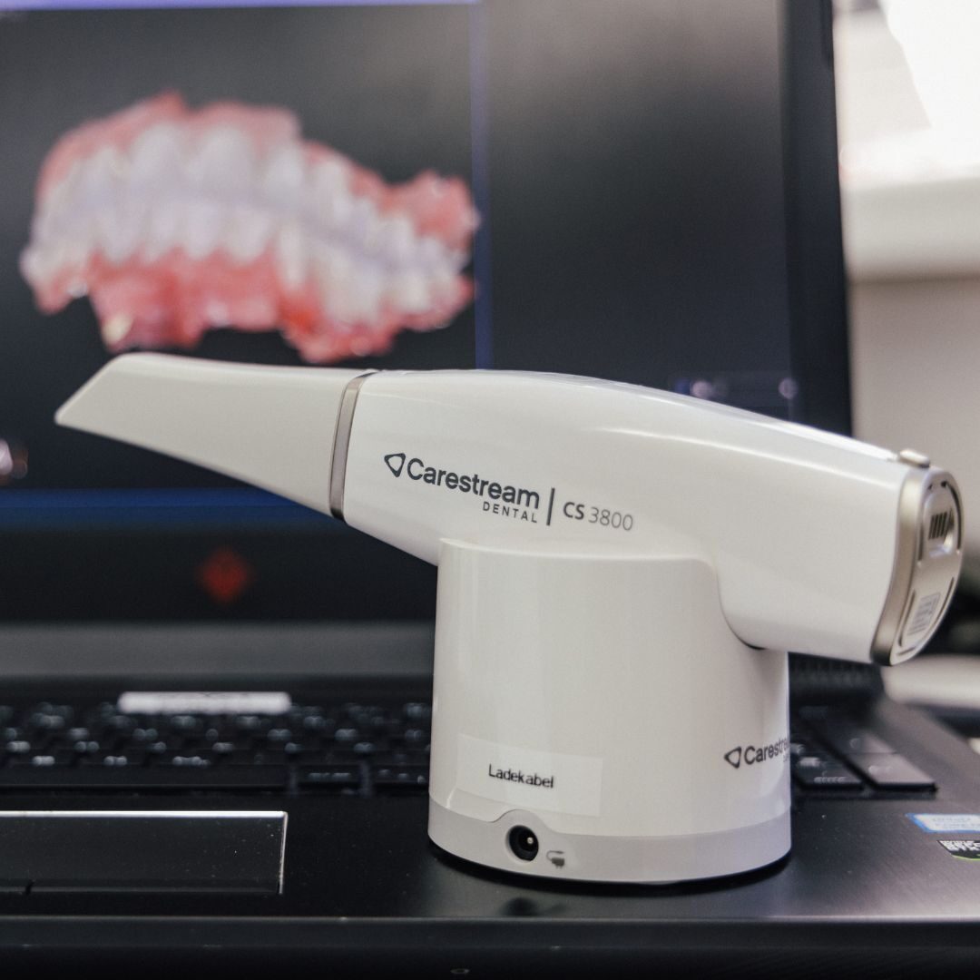 intraoralscanner